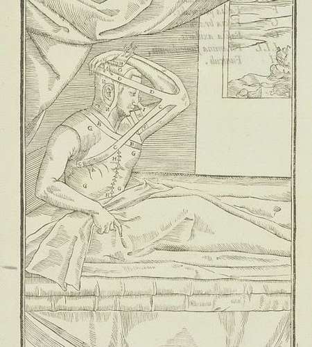 World’s First Nosejob?