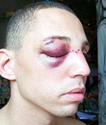 Gay Bashing Outside of NYC McDonald’s
