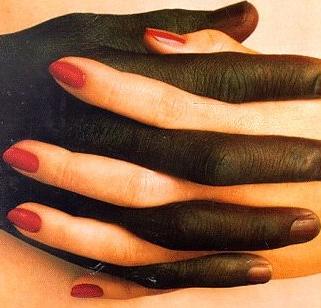 Half of MS Republicans Think Interracial Marriage Should Be Illegal