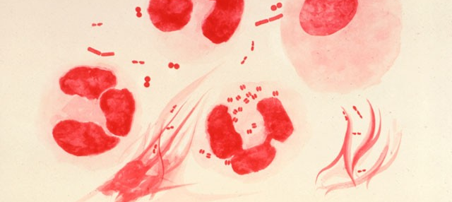 Coming Soon: Incurable Super Gonorrhea En Route From Japan