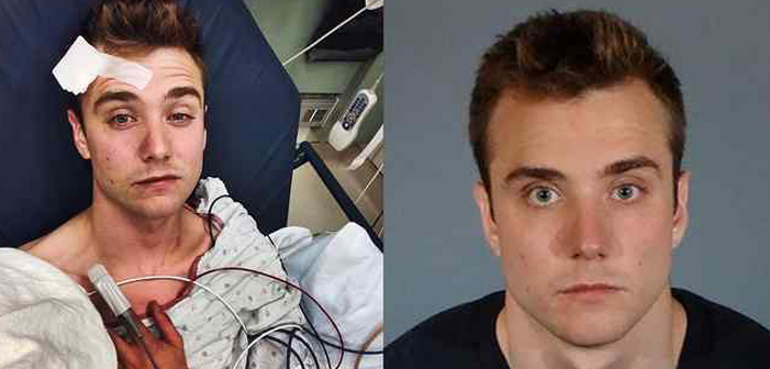 Gay YouTuber Calum McSwiggan Pleads Guilty to Felony Vandalism After Allegedly Fake Gay Bashing Report