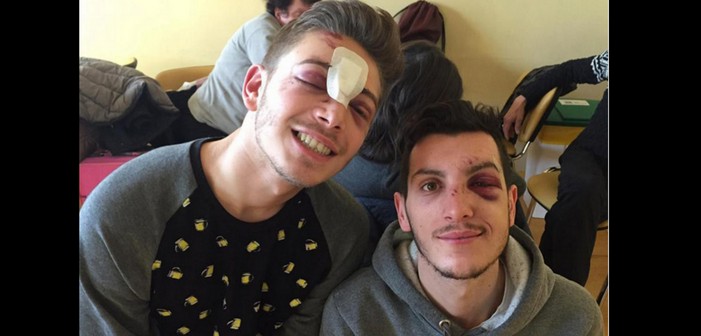 Violente agression homophobe à Milan, l’une des victimes témoigne