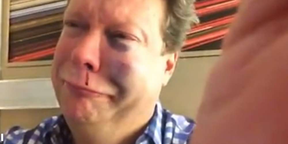 Gay Man Bashed in San Diego: ‘I Blame Trump and Those Who Support Him’ (Video)