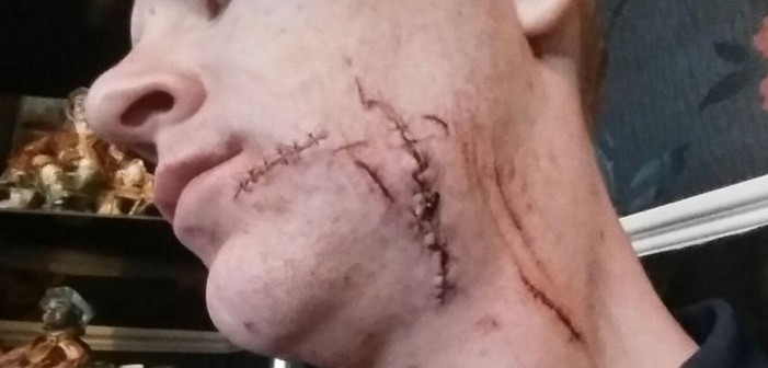 Man Slashed and Disfigured By Two Men After Being Called A ‘Fag’