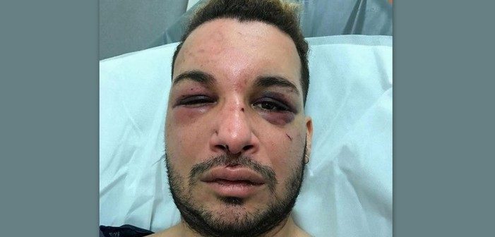 L’avocat d’un des agresseurs de Zak, militant LGBT séquestré, violé et battu, nie le caractère homophobe