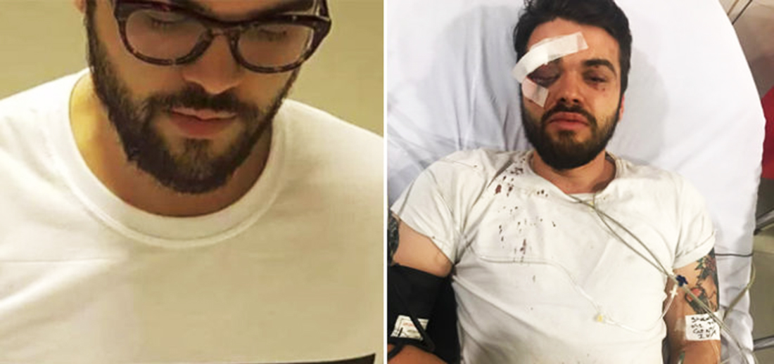 Atleta argentino é agredido por “comportamento gay” e pode ficar cego
