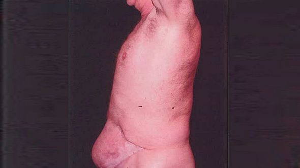 penis settlement nine months pregnant