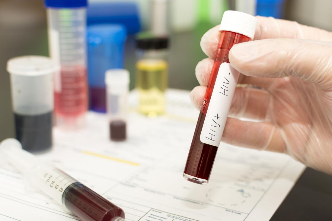hiv self-test 2